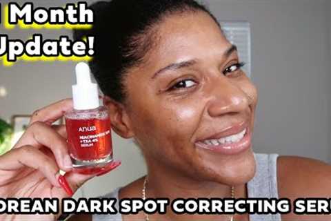 1 Month Update - Anua Niacinamide TXA Serum for Hyperpigmentation on Dry Skin