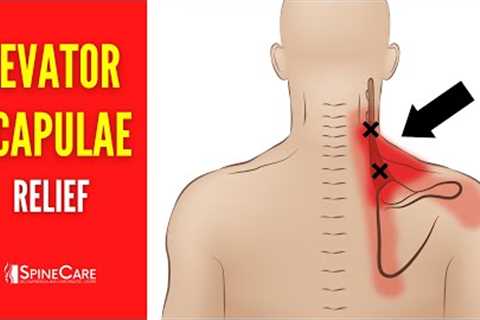 How to Fix Levator Scapulae Pain FOR GOOD
