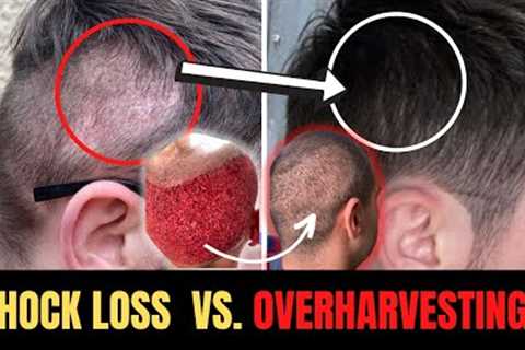 Shock Loss or Overharvesting? How To Spot The Difference
