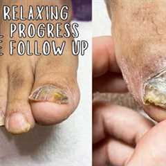 Best Toe nail Improvement and Relaxing Pedicure