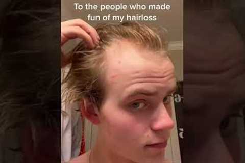 To the people who made fun of my hairloss