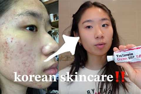 HOLY GRAIL skincare CLEARED my acne with tretinoin