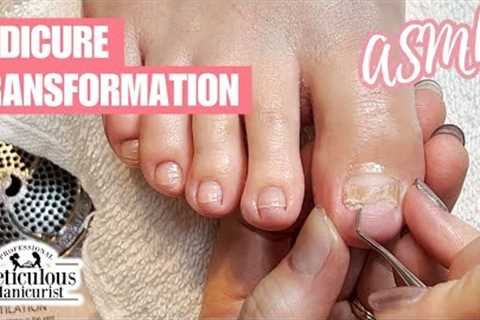 ASMR Big Toenail at Home Pedicure Progress #nails #satisfying