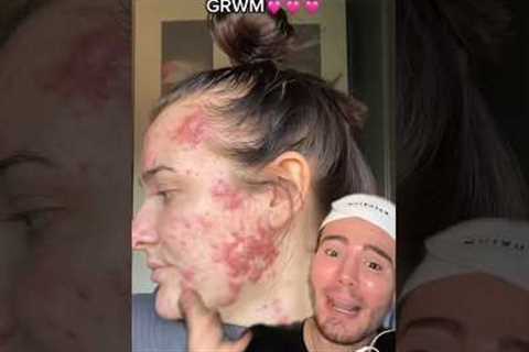 VIRAL SKINCARE ROUTINE!😱 (follow for more!💗)  #skincare #skin #acne #beauty #beautytips