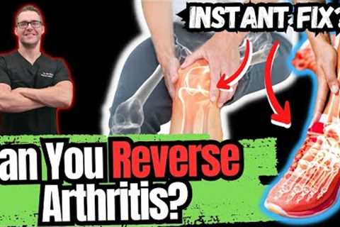 BEST 5 Ways to STOP Arthritis Pain [Big 2023 New SECRETS!]