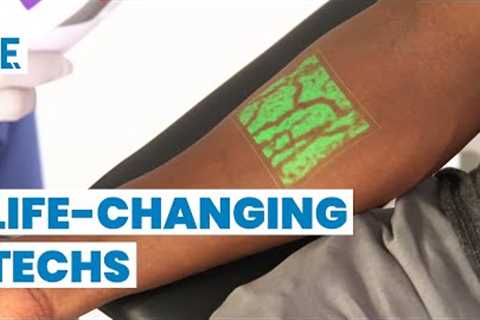 20 Life-Changing Medical Inventions