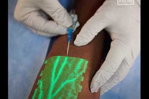 New medical technology helps nurses insert an IV on the first try