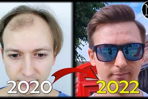 How I Regained my Hair!