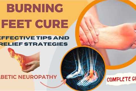 How to Effectively Manage the Burning Sensation of Your Feet Due to Diabetes | Cult Fit | CureFit