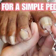 Simple DIY Pedicure on Thick Toenails ASMR