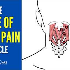 The Base of the Skull Pain Muscle (How to Release It for INSTANT RELIEF)