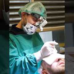 HAIR TRANSPLANT DAY OF A PATIENT