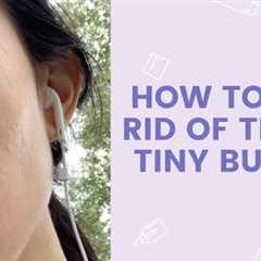 How to Get Rid of Those Tiny Bumps | FaceTory