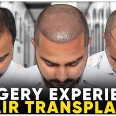 Hair Transplant in Palanpur | Best Results & Cost of Hair Transplant in Palanpur