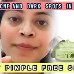 Plum Green Tea Oil Free Moisturiser | oil and acne prone skin #acne #moisturizer