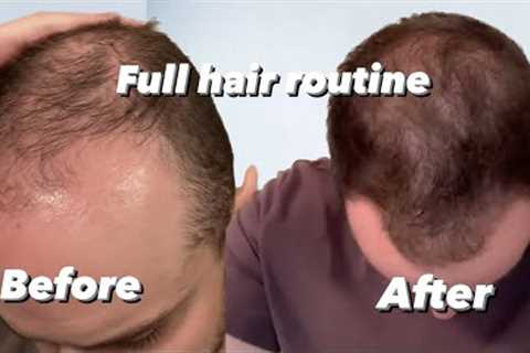 The Hair routine that saved my hair… (Reversing hair loss: EP 2)