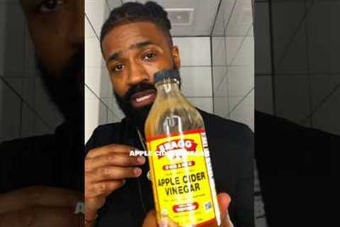 Receding Hairline? This Liquid Gold Changes Everything! (Hair Loss Tips 3/100)