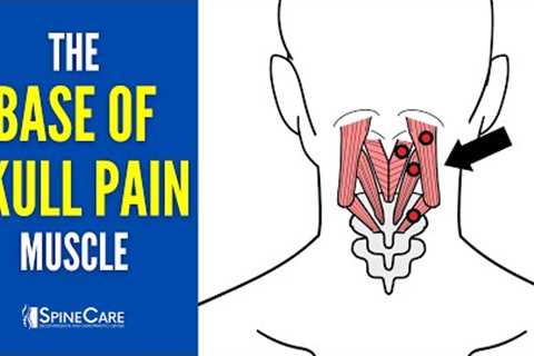 The Base of the Skull Pain Muscle (How to Release It for INSTANT RELIEF)