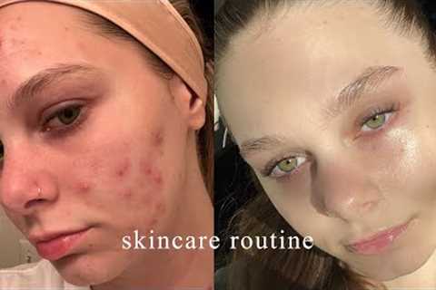 the skincare routine that FINALLY cleared my acne