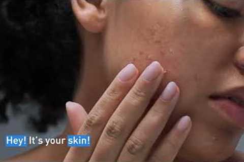 Clear Acne and Prevent New Breakouts │ CeraVe Skincare