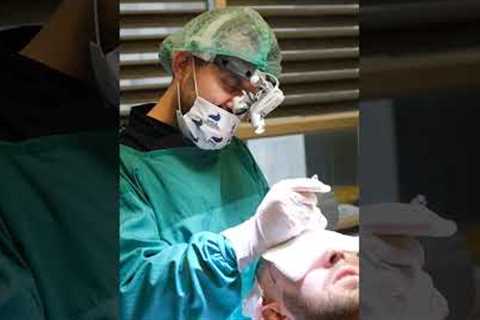 HAIR TRANSPLANT DAY OF A PATIENT
