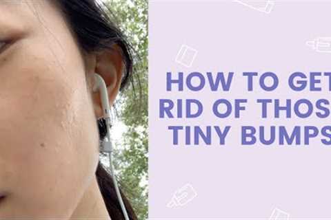 How to Get Rid of Those Tiny Bumps | FaceTory
