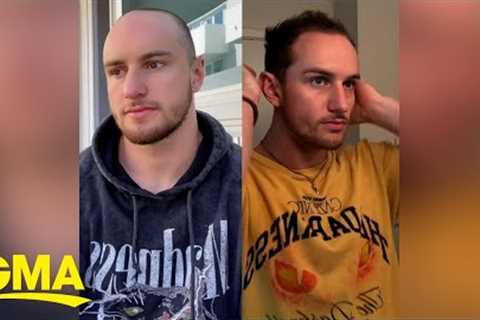 TikTok influencer who started losing hair at 19 breaks stigma around male hair loss l GMA