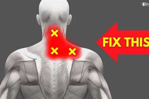 How to Fix Neck and Upper Back Pain FOR GOOD