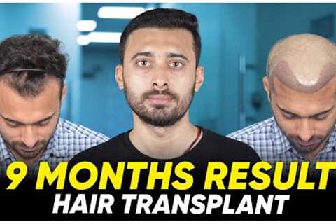 Hair Transplant in Spain | Best Results & Cost of Hair Transplant in Spain