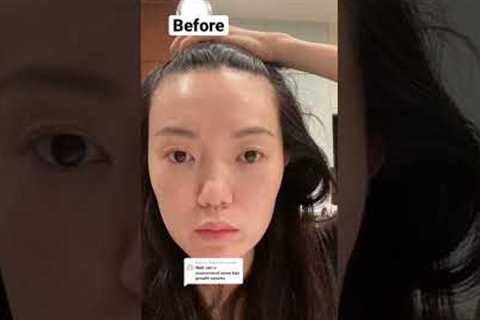 These were my results after 1 month of using my Maya Chia hair growth serum + Nutrafol supplements