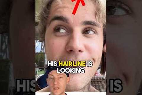 Justin Bieber’s NEW HAIR | Surgeon Analysis