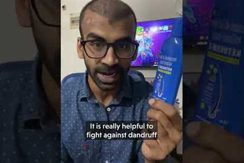 Answering Questions on my #HairTransplant Journey #hairlinetransplant #haircare #hairloss
