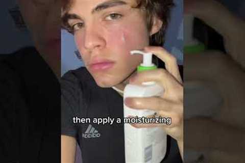 How to avoid acne