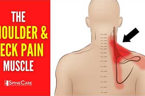 The Neck and Shoulder Pain Muscle (How to Release It for INSTANT RELIEF)