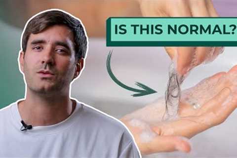Is Hairloss In Shower Normal?