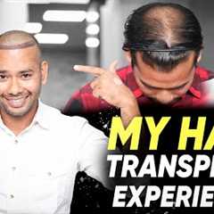 Hair Transplant in Jodhpur | Best Results & Cost of Hair Transplant in Jodhpur