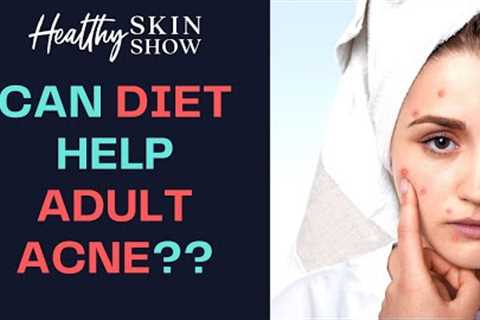 Can FOOD Help Adult ACNE? | Brie Wieselman