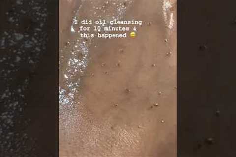 What happens when you do oil cleansing for 10 minutes 😅
