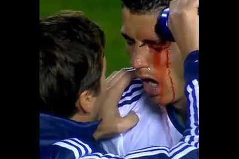 RONALDO RARE MOMENTS | Shocking Ronaldo moment | ronaldo moments #funnyfootball-top
