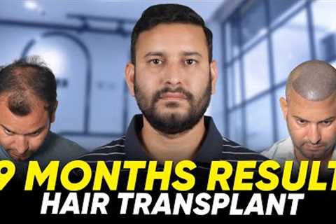 Hair Transplant in Istanbul | Best Results &amp; Cost of Hair Transplant in Istanbul