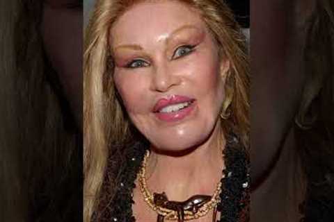 10 Worst Celebrity Plastic Surgery Fails That Shocked the World 😱  Part 1