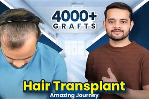 Best Hair Transplant in Bangalore | Amazing Results &amp; Cost of Hair Transplant in Bangalore