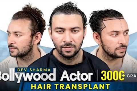 Bollywood Star's Secret Revealed: Dev Sharma's Hair Transplant! #hairtransplant