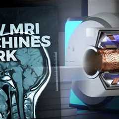 The Insane Engineering of MRI Machines