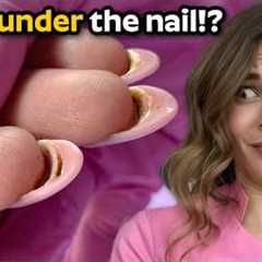 Dark spots and HOLES in the nail extensions!?