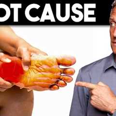 Peripheral NEUROPATHY (Root Cause and Best Remedy) — Dr. Berg