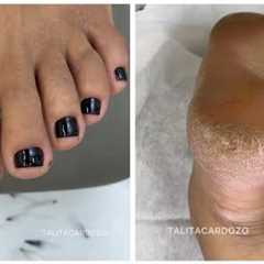 Black and white pedicure + talitacardozo feet treatment