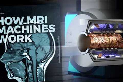 The Insane Engineering of MRI Machines