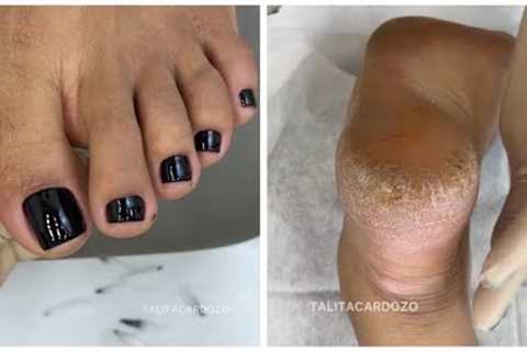 Black and white pedicure + talitacardozo feet treatment