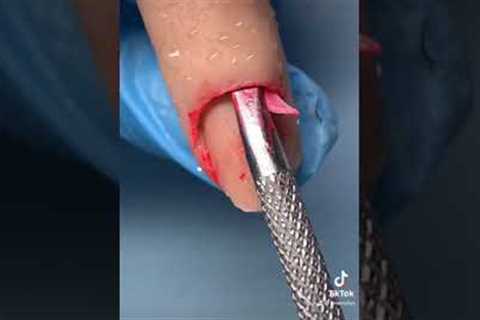 WATCH ME FIX MY CLIENTS NAIL🤢💅🏼(OMG)😳